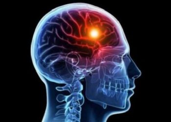 دراسة طبية تؤكد أن التحفيز العصبي قد يحد من تلف السكتة الدماغية