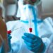 هل يؤدي لقاح كورونا إلى جعل نتيجة اختبار PCR إيجابية؟