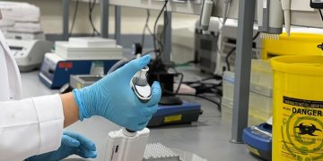 خطوة طبية متقدمة: تشغيل أول فحص مطابقة مناعية بتقنية التدفق الخلوي محليًا