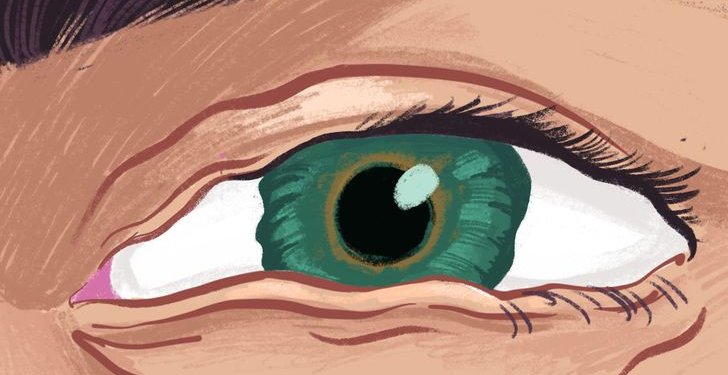 لماذا ترتجف العين فجأة؟ أسباب شائعة وراء رفّة الجفن